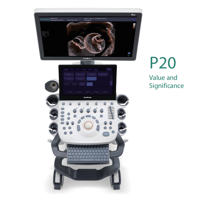 High Quality Sonoscape 4d 3d Ultrasound Machine Ultrasonido Veterinariy Human Ultrasounde Scanner