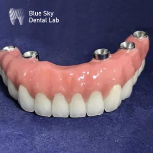 Universal Autoclavable Rectangular Implant Cases Smooth Surface Silver Color