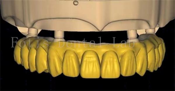 Quality OEM Dental Crown Design Uses Advanced Scanning And 3D Printing Technology for sale