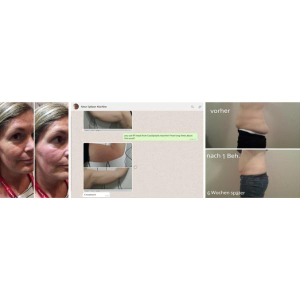 2018 OEM factory price best quality most professional grey Cryolipolysis slimming machine for clinic