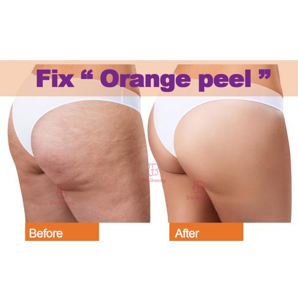 R- Sleek Roller Muscle Massager Therapy Slimming Machine