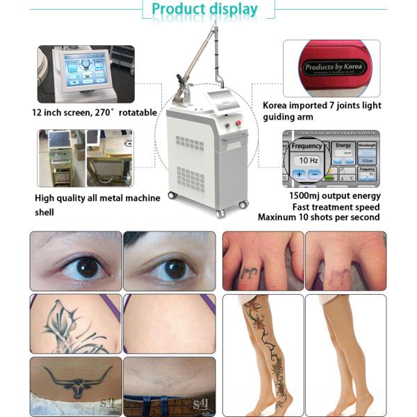 New model birth mark long pulse tattoo removal q switch laser for hyperpigmentation