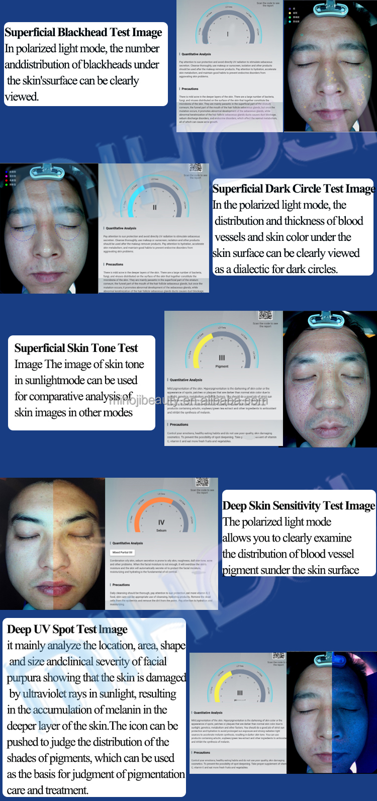 Skin Analyzer with 36 Million Pixels Camera and Pigmentation Analysis Function at Design