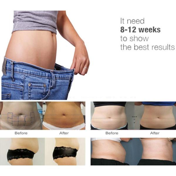 Non Invasive Face Lifting Body Slimming Hifu Liposonix Machine