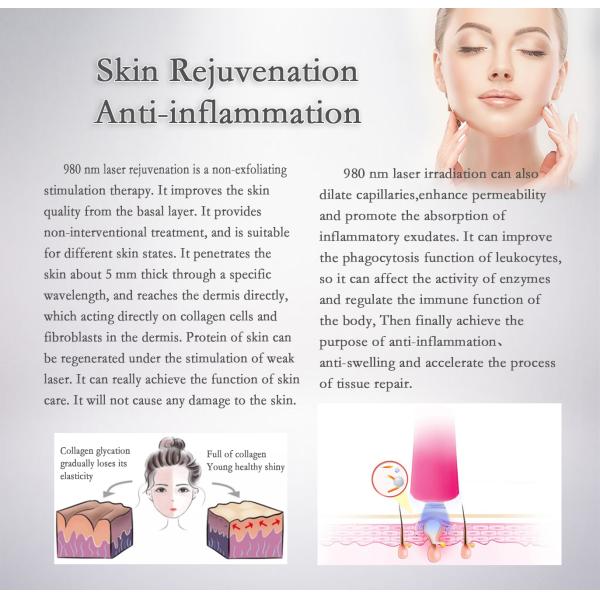 980nm Nail Fungus Removal Laser Machine Non Invasive Type Laser Treatment For Nail