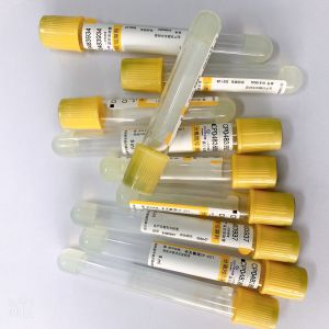 Medical Gel And Clot Activator Tube 3ml 4ml 5ml Accurate Vacuum Draw Volume