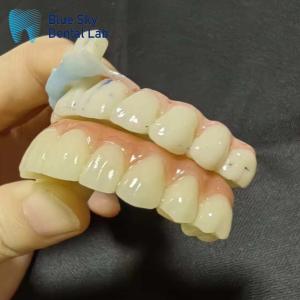 Implantation Cases Artificial Implantation Cases for Seamless System Compatibility