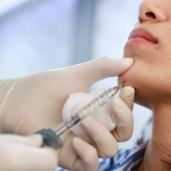 Quality Hyaluronic Gel Injections Medical Injectable Hyaluronic Acid Gel Cross Linked 24mg/Ml for sale