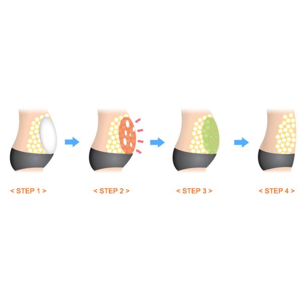 Removing Body Fat Injecting 10ml Hyamely Lipolytic Solution Thin