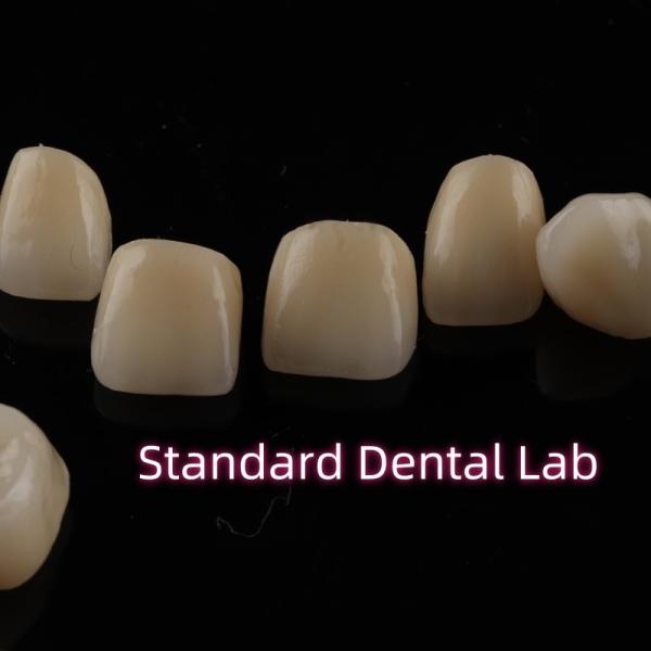 Quality Dental Strong Layered Zirconia Crowns Full Upper Arch Restoration for sale