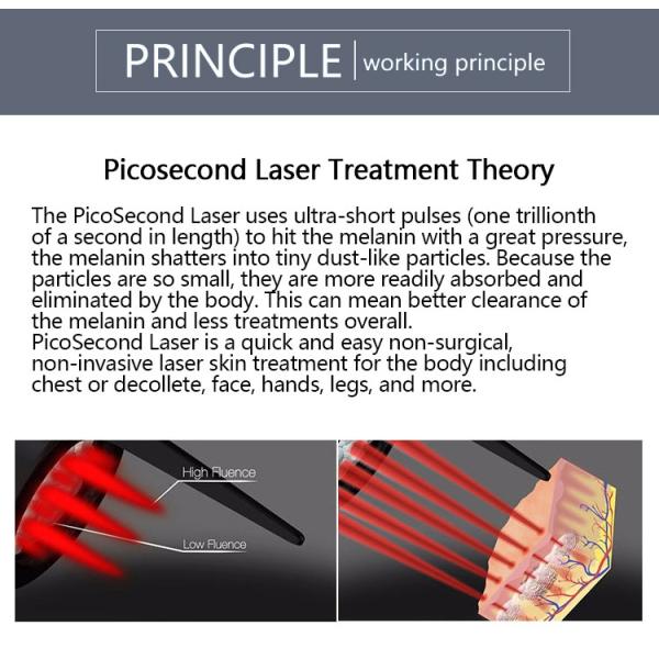 Picosecond Carbon Laser Peel Machine