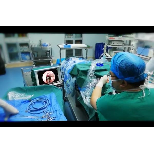 Medical Multi Display IOS Endoscope Camera3000k-8000k