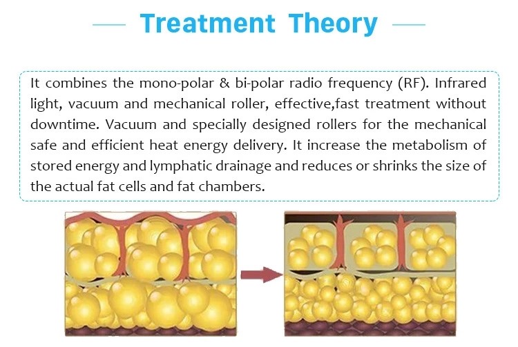 radio frequency device Vacuum liposuction sliming machine shape beauty machine Vacuum roller vela slim