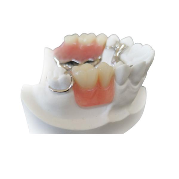 Quality Custom Smooth Surface CAD CAM PFM Crown Bridge High Definition for sale