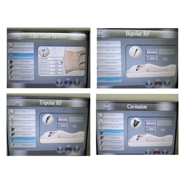 5MHz Multipolar RF Radio Frequency Fat Reduction Machine Better For Whiten Skin