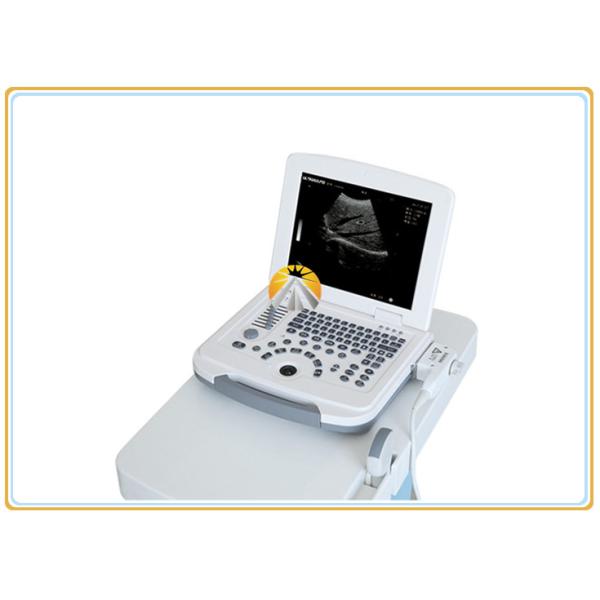 12.1 Inch LED Display Ultrasound Scan Machine 96 Elements Convex Probe