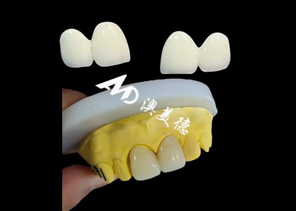 Quality Custom Zirconia Dental Crown Precise Fit Tooth Cap from China dental lab for sale
