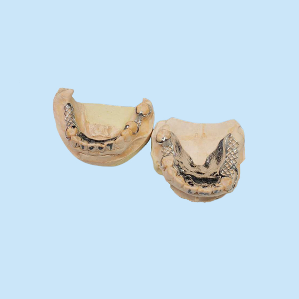 High Accuracy CAD-CAM Fixed Removable Bridge Digitization Design
