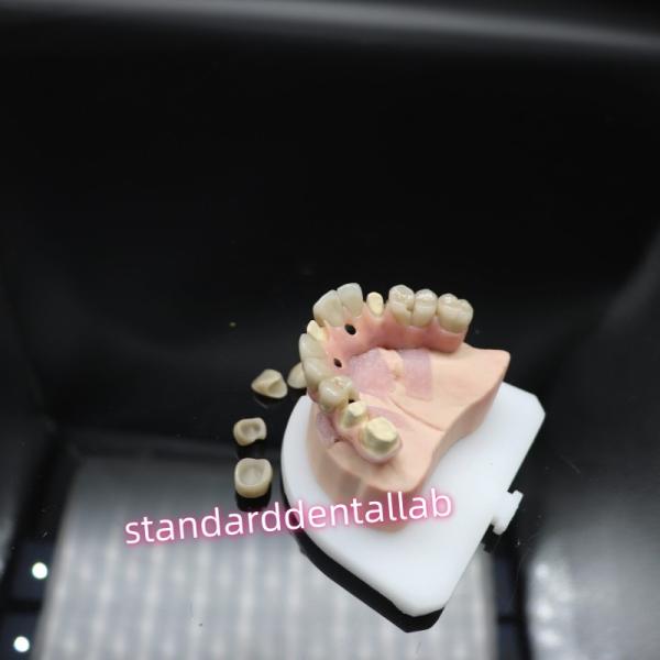 Quality Digital Dental Malo Implant Bridge Titanium Ivoclar Hybrid Zirconia Bridge for sale