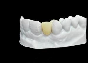 Chipping Resistance Zirconia dental Crown With Exceptional Strength And Translucency