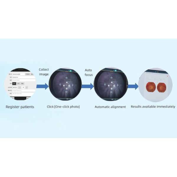 True Color Wide Field Fundus Camera with 8μm Optical Resolution and 27-inch HD Color Monitor for Retinal Imaging