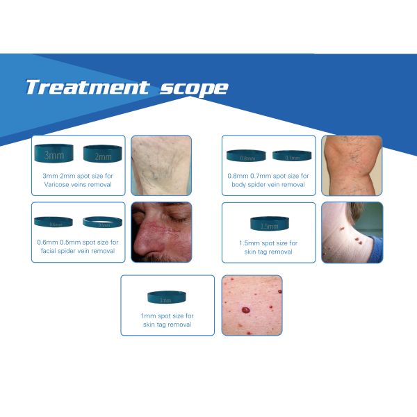 980nm diode laser 30w therapy laser spider vein removal machine
