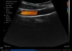 Digital Wireless Handheld Ultrasound Scanner Wifi Connection Cardiac Linear