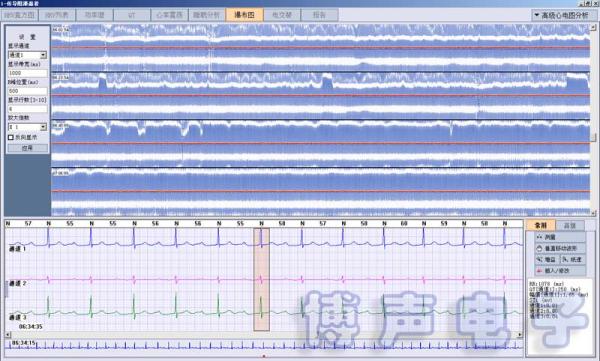 Quality BORSAM PC Based EKG Analyzer Holter ECG Software System for sale