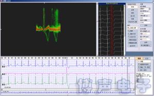 iTengo+ Holter ECG Analysis Software System Workstation Holter Monitor