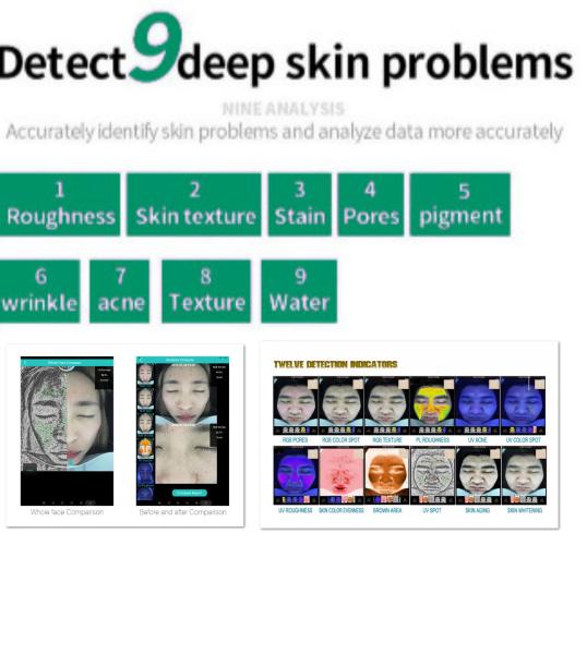 Quality High Definition Skin Home Analyzer 3d Function Digital Images 9kg Nw for sale