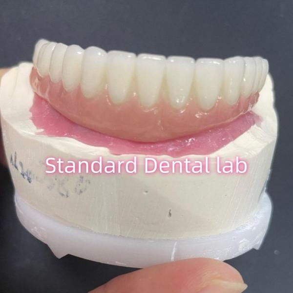 Esthetic Restoration All On 4 Dental Implants Zirconia Hypo Allergenic