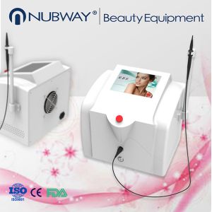 China RBS 30Mhz best vein treatment removing veins from face wholesale