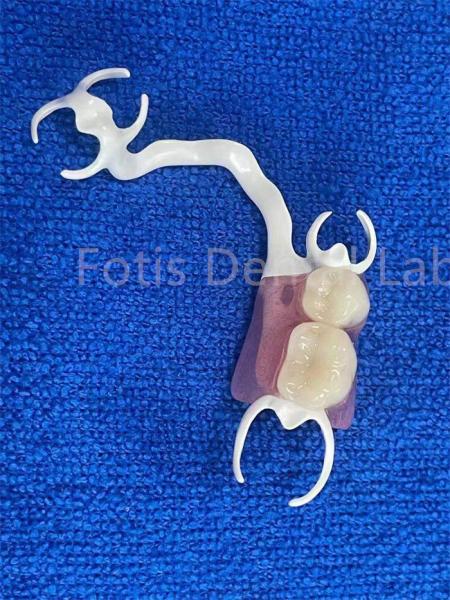 Quality Customizable Comfortable Removable Partial Denture For Stable Teeth Replacement for sale