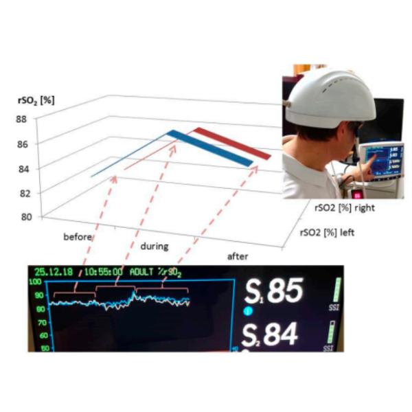 Diode 810nm Neuro Brainwaves Photobiomodulation Therapy Machine