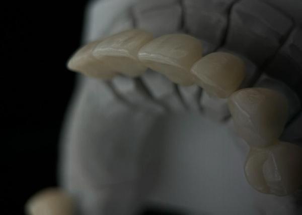Quality Fit Monolithic Zirconia Tooth Crown With Translucency And Resistance for sale