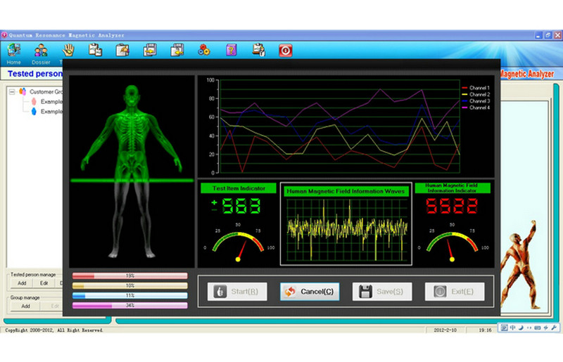 Quantum Weak Magnetic Resonance Analyser , Body Health Machine 38 Reports