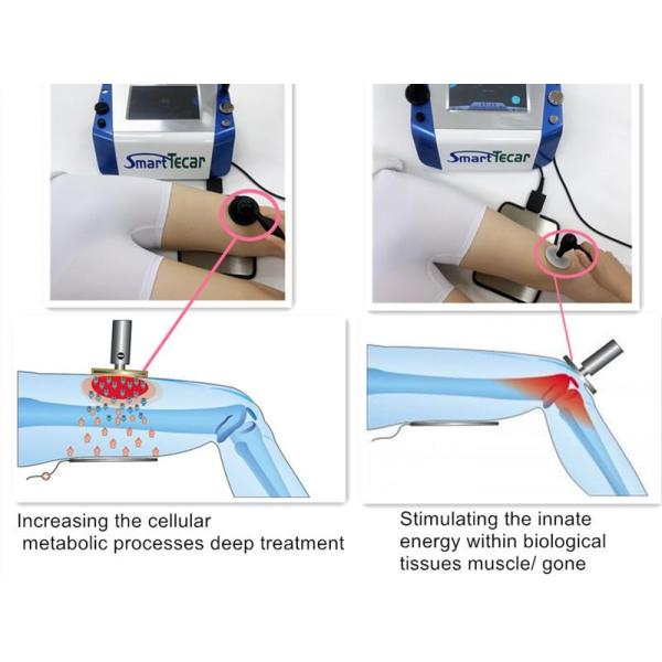 Chiropractic Physio Spine Pain Tecar Therapy Machine