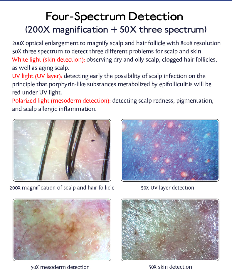 Desktop Scalp Analysis Care Machine for Skin Hair and Follicle Analysis For Commercial