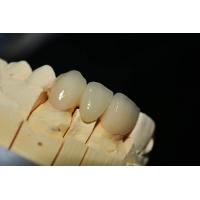Customized Zirconia Denture Dental lab - Fast Delivery and Repair for sale