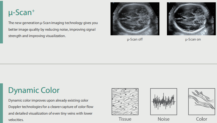 High Quality Sonoscape 4d 3d Ultrasound Machine Ultrasonido Veterinariy Human Ultrasounde Scanner
