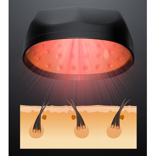 OEM ODM Alopecia Areata Laser Hair Growth Caps For Hair Rejuvenation