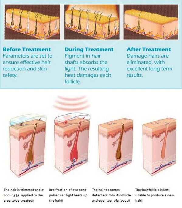 Chinese Manufacturer for Salon Use Three handles Multi-functional IPL Skin Treatment IPL haarentfernung machine