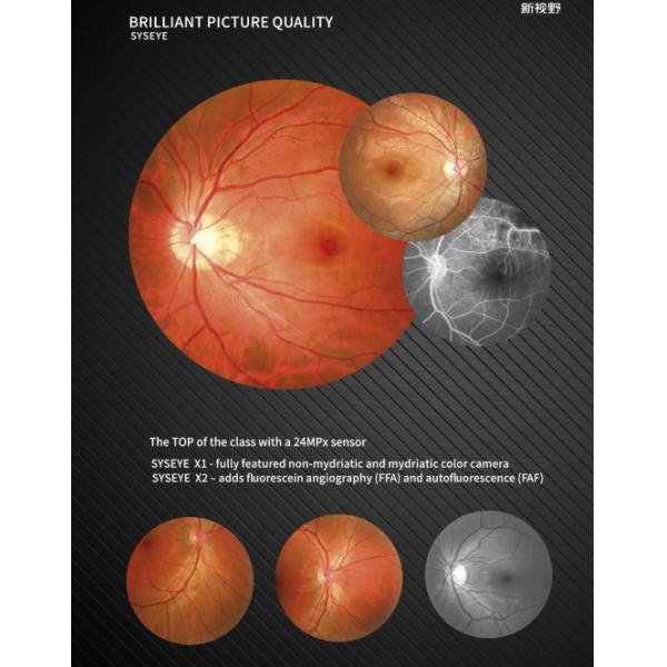 Highly Accurate Retinal Fundus Camera And Easy To Use Digital Fundus Camera