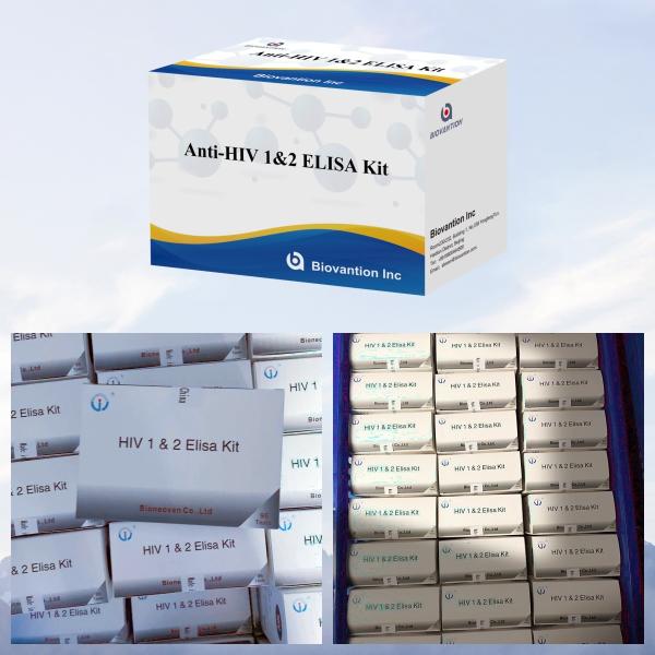 High Sensitivity HIV ELISA Test Kit for Blood Screening with 96 Tests and CE Certified