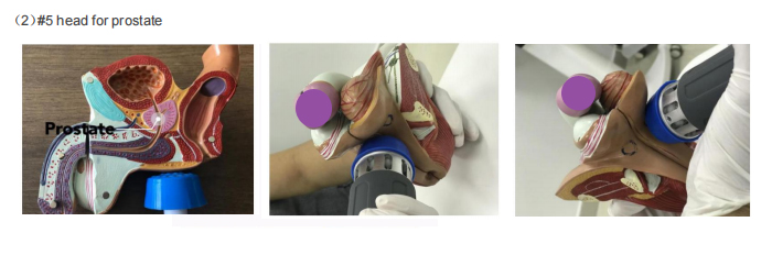 Capsular Contracture Muscle Home Shockwave Therapy Machine For ED extracorporeal shock therapy shockwave machine