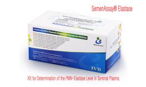 China Economical Sperm DNA Fragmentation Test Kit For DNA Fragmentation Level Determination--sperm chromatin dispersion method wholesale
