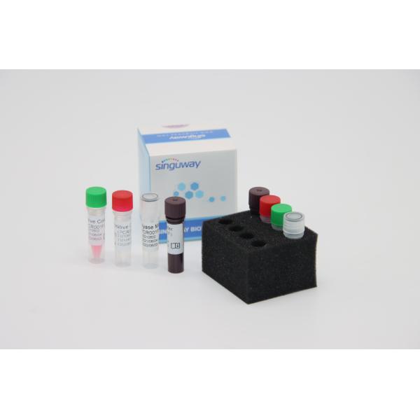 Boca Virus HBoV RT PCR Swab Test Kit ISO9001 Quantitative Fluorescent Test PCR Kit