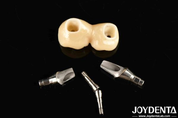 Quality Experience Aesthetically Pleasing Results With Customizable Implant Retained Crown And Bridge for sale