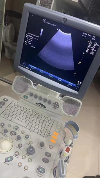 Quality GE original OB/GYN ultrasound machine LogiqP5 for sale