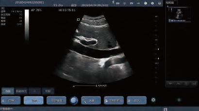 Mobile Phone Handheld Ultrasound Scanner Convex Linear Transvaginal Micro Convex Changeable Probe